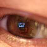 Eyeball
