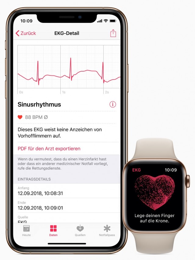 Apple-iPhone-watch-ecg-de-screen-03272019